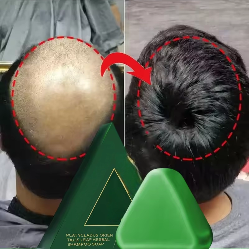 Cypress Leaf Hair Growth Soap – Strong Roots, Less Hair Loss